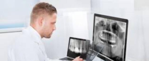 Как делается панорамный снимок зубов. Ортопантомограмма или панорамный снимок зубов: цена и преимущества исследования, для чего проводится процедура