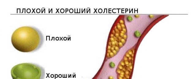 Определение триглицеридов в сыворотке крови ферментативным методом. Определение концентрации триглицеридов в сыворотке крови