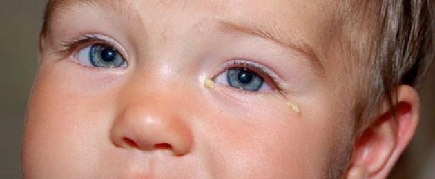 Закисают глазки у ребенка комаровский. Закисают глаза у ребенка — симптомы, причины и чем помочь? Массаж глаз у новорождённых