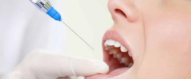 Больно ли вырывать зуб: от чего это зависит и как проходит операция. Как происходит удаление коренного зуба