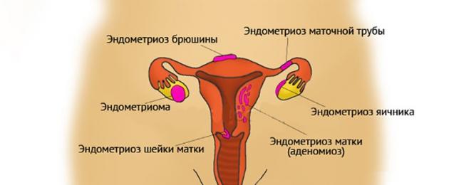 Premenopausa e dolore al basso ventre durante le mestruazioni.  Perché l'utero fa male in menopausa?  I principali fattori del dolore