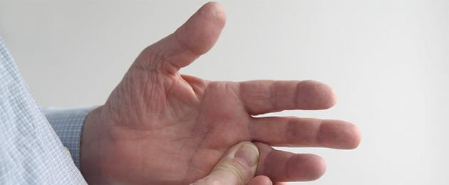 Что такое артрит пальцев рук. Как снять воспаление суставов пальцев рук