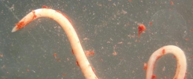 Клеточное строение круглых червей. Круглые черви: краткая характеристика типа