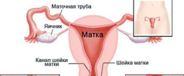 Что такое орошение полости матки. Эффективные и опасные народные способы лечения бесплодия: мнение акушеров-гинекологов