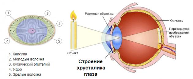 Gli svenimenti si verificano a causa della cataratta dell'occhio?  Cataratta: sintomi, cause, tipi e trattamento della cataratta