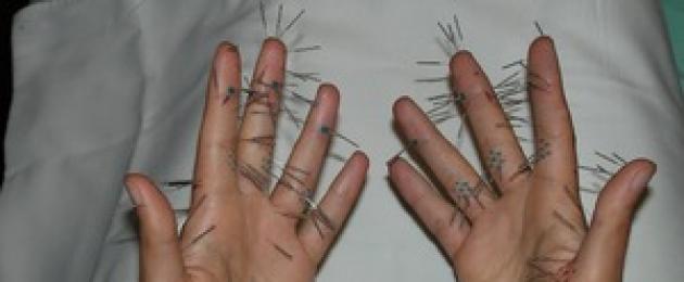 Пять распространенных причин возникновения черных точек на коже рук. Черные точки на ладонях