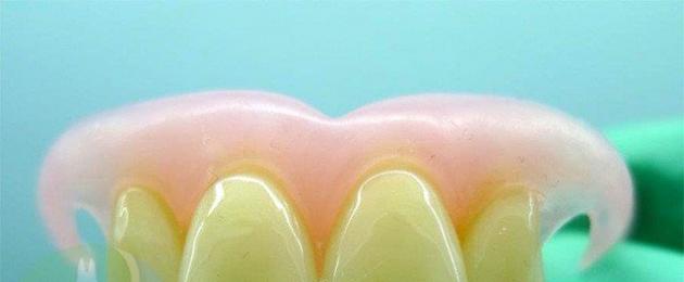 Косметическое протезирование. Косметическое протезированию зубов