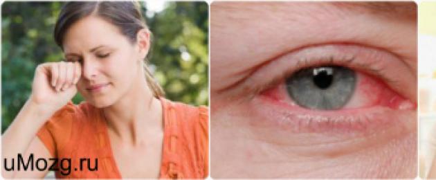 Какие глазные капли помогут от светобоязни. Симптомы и лечение повышенной светочувствительности глаз