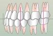 Окклюзия зубов: виды, симптомы, лечение Что такое центральная окклюзия