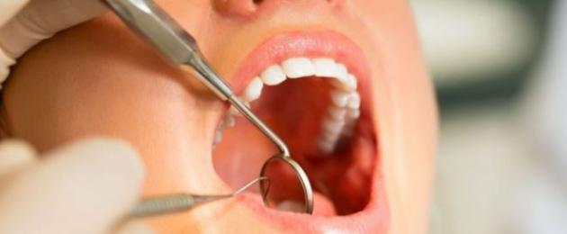 Что значит зубной врач. В чем отличия между стоматологом и зубным врачом? Что делает стоматолог при осмотре полости рта
