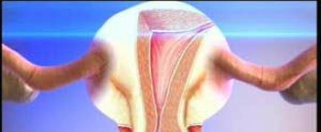 Рак шейки матки: операции. Хирургический метод лечения рака шейки матки
