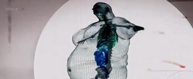Мрт весом более 120 кг. МРТ для полных людей — как делать диагностику людям с большим весом