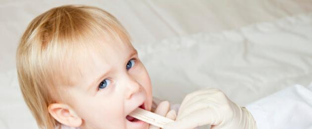 Cos'è la tonsillite cronica nei bambini.  Tonsillite in un bambino: sintomi e trattamento della malattia