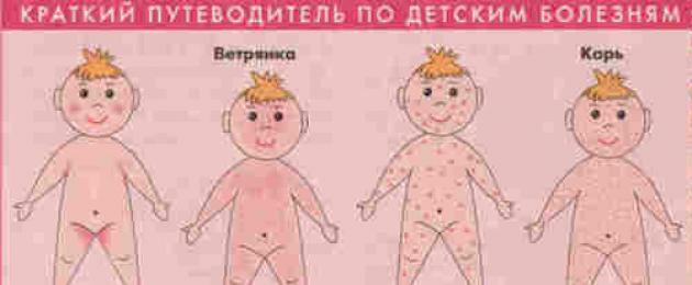 Сыпь у ребенка по всему телу без температуры. Что делать, если у ребенка обнаружена сыпь на теле? Почему у маленького ребенка может возникать сыпь по телу без температуры